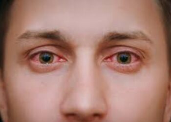 Around 15,000 cases of ‘Eye Flu’ in J&K
