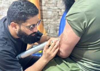 Erasing tattoos: Basit takes on this mission for free of cost
