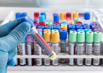 6000 lab tests being done in SMHS hospital on daily basis