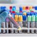 6000 lab tests being done in SMHS hospital on daily basis