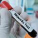 Hepatitis-A cases among children detected in Bandipora villages