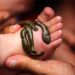 Leech therapy thrives in Kashmir despite modern medical advances