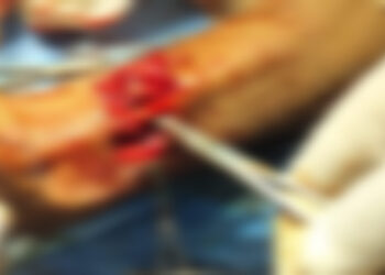 First-Ever Tendon Repair Procedure Successfully Performed at Sub District Hospital DH Pora